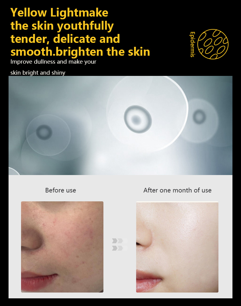 led mask yellow light benefits