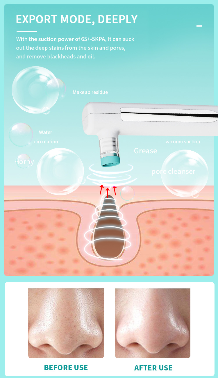 microdermabrasion benefits