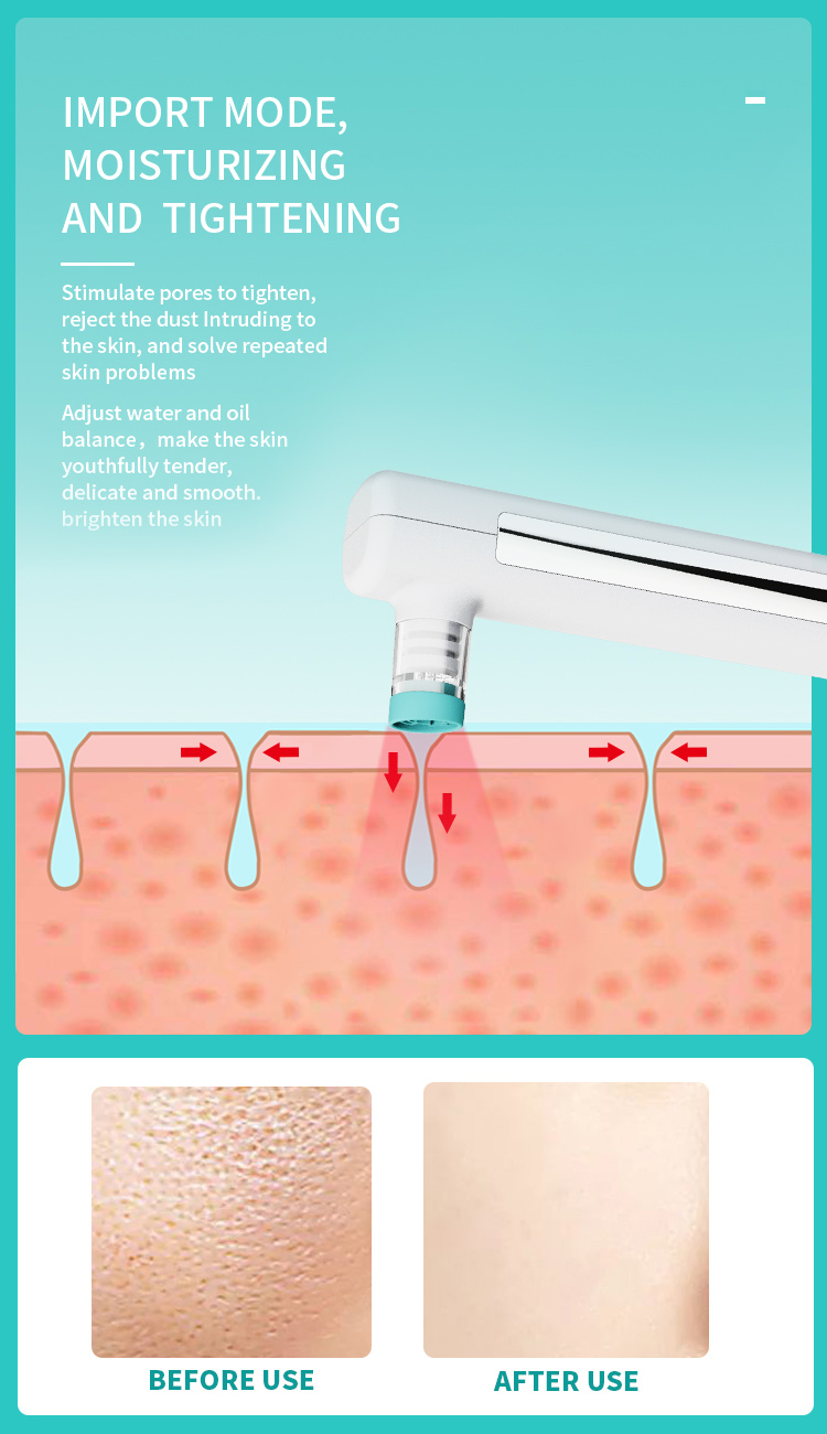 microdermabrasion treatment