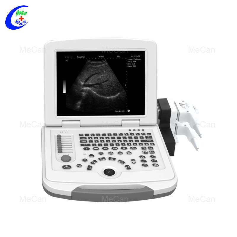 Najkvalitetnija prijenosna mašina za ultrazvučni skener, tvornica ultrazvučnih skenera za potpuno digitalne laptope