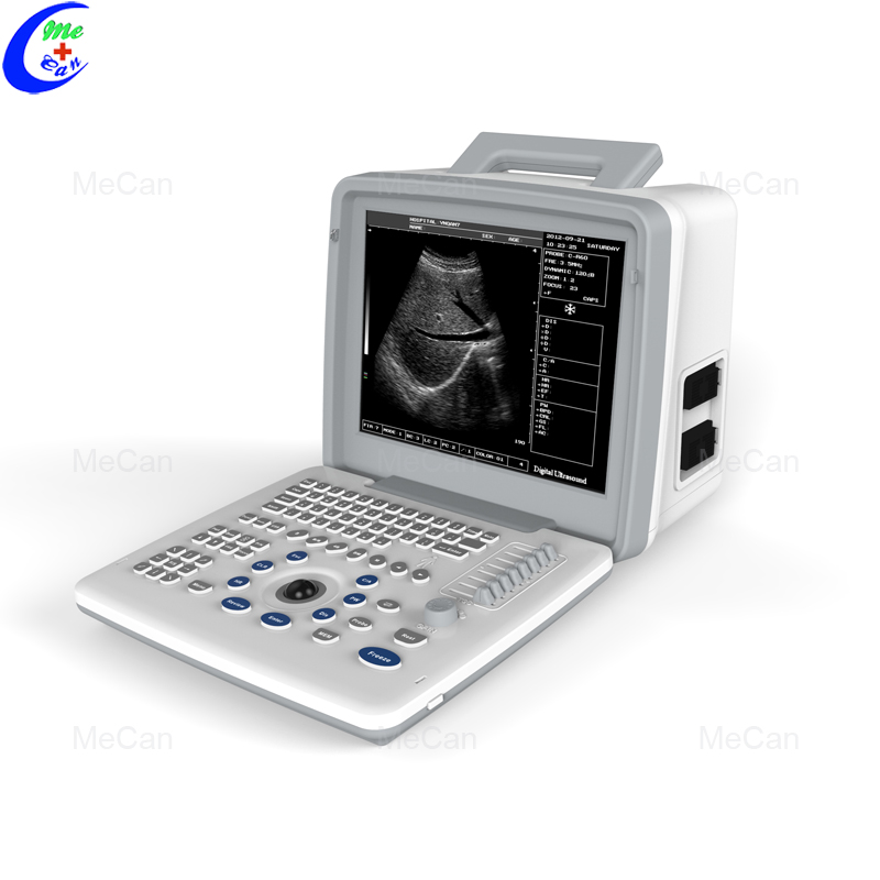 Najbolji medicinski prenosni ultrazvučni skener kompanije za crno-beli ultrazvučni aparat - MeCan Medical