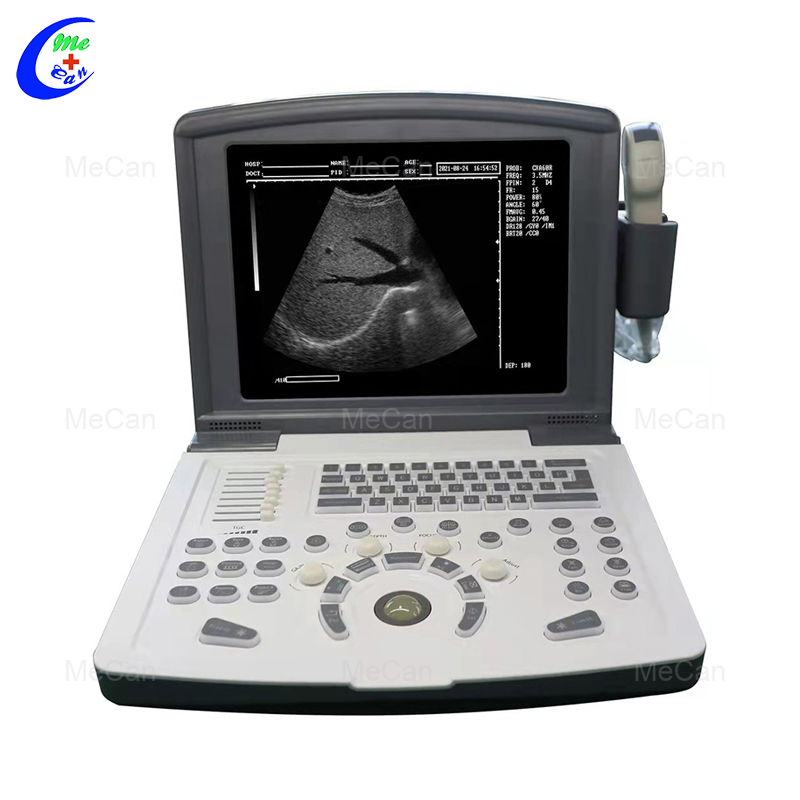 Kvalitetan B/W ultrazvučni uređaj, proizvođač potpunog digitalnog ultrazvučnog skenera | MeCan Medical
