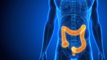 Rick Simpson Cannabis Oil for Crohn's Disease 90 day protocol - RsoCancer Free