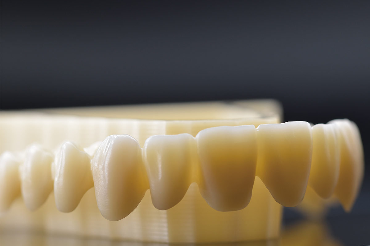 Zirconia Dental Bridges Comprehensive Guide on Benefits, Costs, and