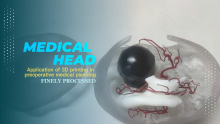 Application of 3D Printing in Preoperative Medical Planning Products | 3D SHAPING